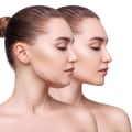 Natural Healing After Neck Lipo In NYC: Natural Remedies For A Smooth Recovery