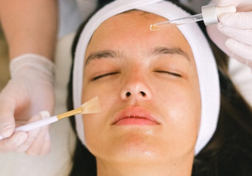 The Benefits Of Using Natural Remedies On Facial Treatments In Los Angeles